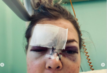 Meta Hrovat se je oglasila prvič po nesreči #foto