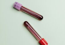 Dan krvnih bolezni: Ko Slovenija zasije rdeče