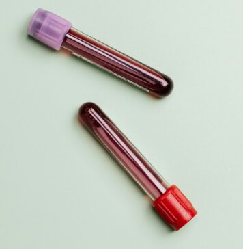 Dan krvnih bolezni: Ko Slovenija zasije rdeče