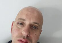 Sojenje zaradi napada na župana v Ribnici: Vse oči na sodišču